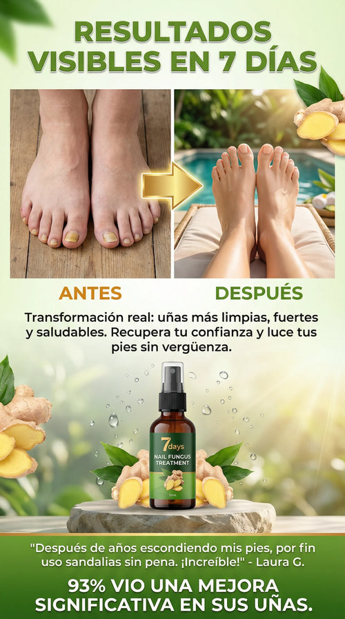 Spray Anti Hongos para Uñas