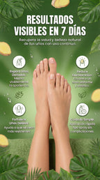 Spray Anti Hongos para Uñas